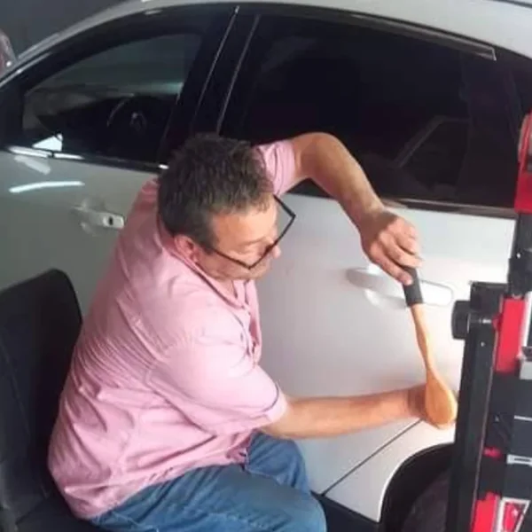 Güneş yanığı öncesi ve sonrası