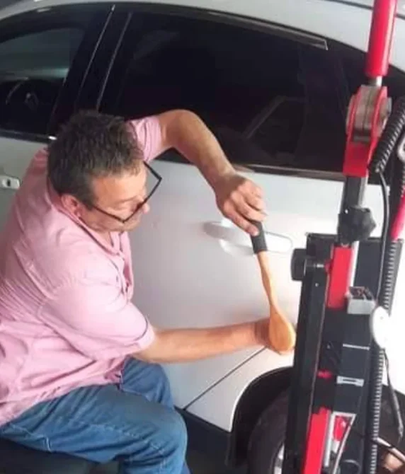 Güneş yanığı giderme